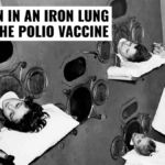 Children in an Iron Lung Before the Polio Vaccine