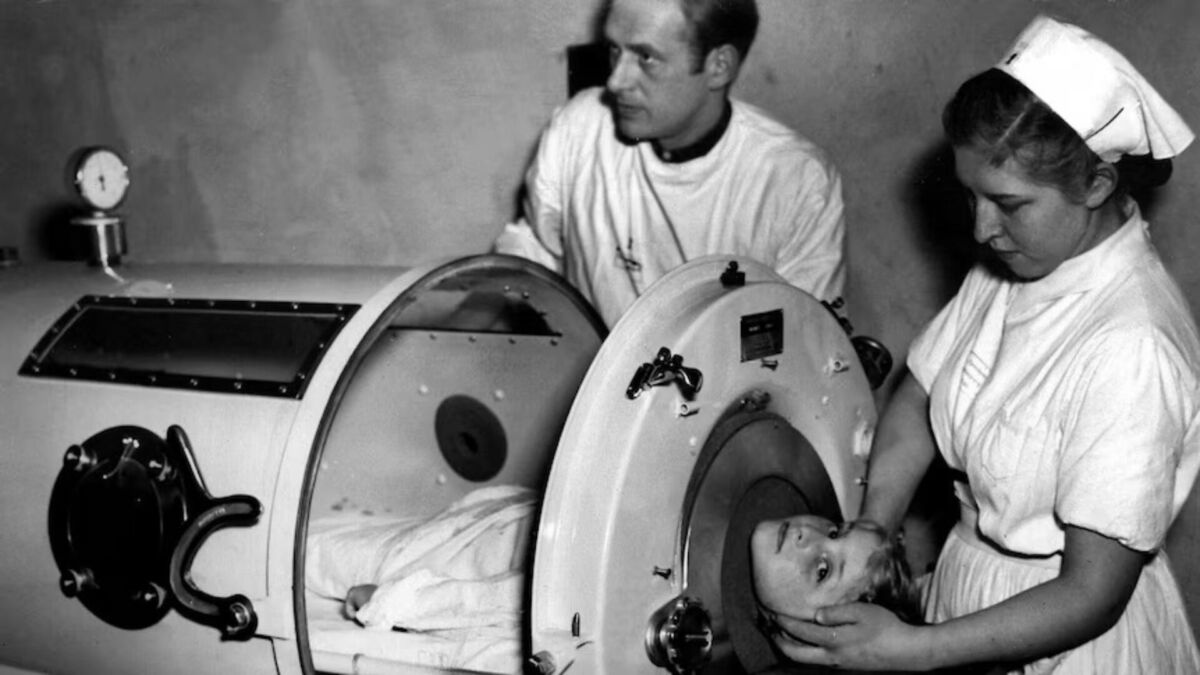 Children in an Iron Lung Before the Polio Vaccine