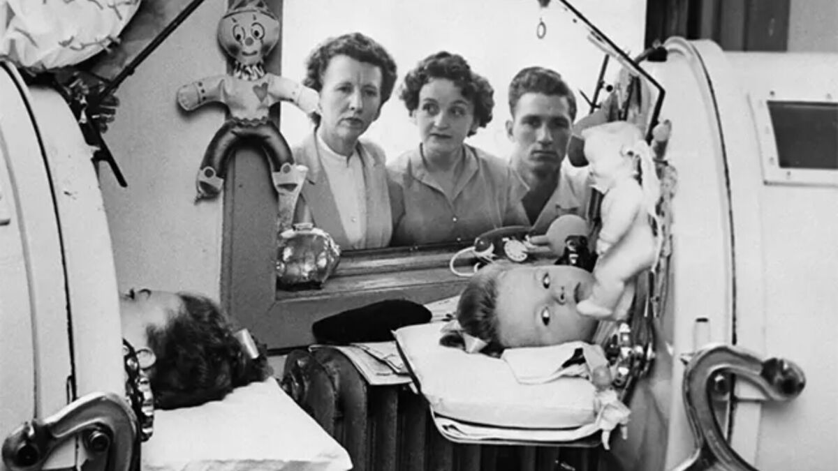 Children in an Iron Lung Before the Polio Vaccine